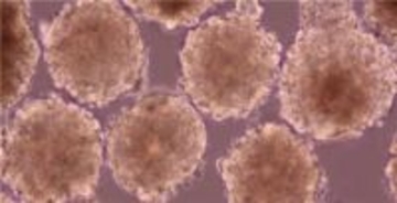 iPS細胞から作った心筋細胞を心臓に注入する治験　患者10人の経過を発表