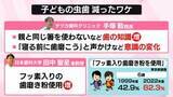 「“大人の虫歯”高止まりのワケ　“子どもの虫歯”は激減…「親と同じ箸を使わない」親の“意識の変化”も要因に？【なるほどッ！】」の画像1