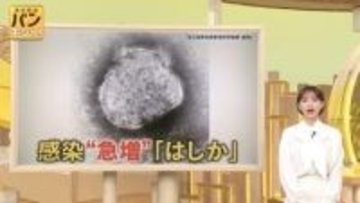 【感染急増のはしか】治療薬は？ 妊婦は？ 街で聞かれたギモン、専門家に聞きました【バンキシャ！】