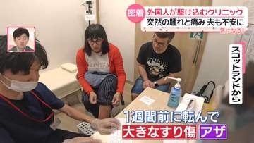 【密着取材】来日の目的は富士登山…なのに足首骨折？　年中無休　外国人が駆け込むクリニック　＜気になる＞