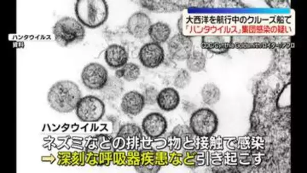大西洋を航行中のクルーズ船で「ハンタウイルス」集団感染の疑い　3人死亡