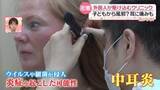 「【密着】外国人が駆け込むクリニック　観光中に“不調”　止まらないせき・耳の痛み…虫刺されで？大きな腫れ、股関節の炎症？ 思わぬ病気か 『every.気になる！』」の画像1