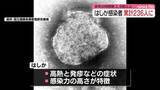 「はしかの全国感染者数　ことし累計236人　去年同時期の3.5倍以上　厚労省が注意呼びかけ」の画像1