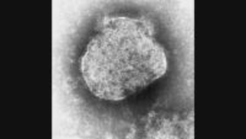 はしかの全国感染者数　ことし累計236人　去年同時期の3.5倍以上　厚労省が注意呼びかけ