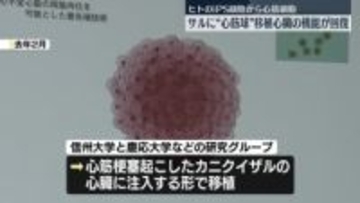 ヒトのiPS細胞から作った「心筋球」サルに移植…心臓の機能が回復　慶応大学などの研究グループ