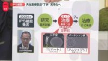 【解説】iPS細胞“製品”世界初の実用化へ　「早期承認」を了承…今後7年かけ有効性・安全性を確認