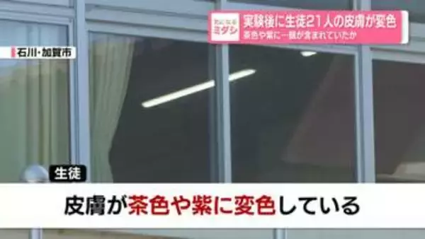 理科の実験後に生徒21人の皮膚が変色　茶色や紫に…銀が含まれていたか　石川・加賀市の中学校