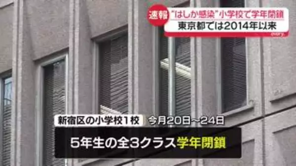 “はしか感染”都内の小学校で学年閉鎖　東京都では2014年以来