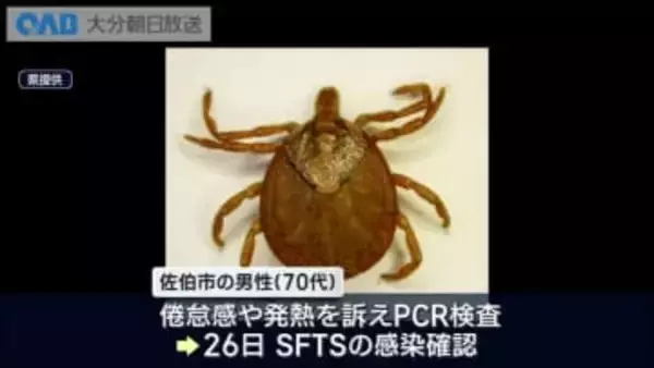 ダニ媒介の感染症“ＳＦＴＳ”大分県内今年１例目　佐伯市７０代男性が感染