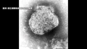 【注意】岡山市で１歳男児と３０代父親が「はしか」に感染　２人とも快方に　感染者は前年の約６倍【岡山】