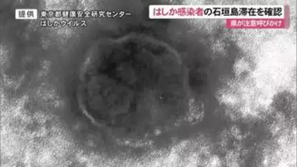 県がはしか感染に注意喚起　県外の男性がり患判明　石垣市内に滞在