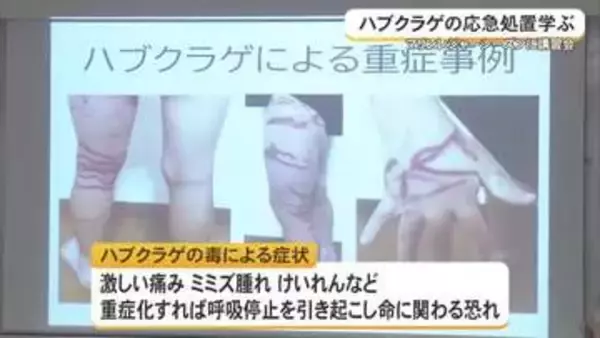 ハブクラゲの応急処置学ぶ　マリンレジャーシーズンに講習会
