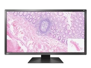 EIZO初、色精度を簡単に維持できる病理画像向け30.5型4Kモニター