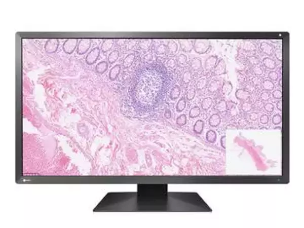 EIZO初、色精度を簡単に維持できる病理画像向け30.5型4Kモニター