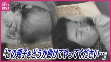 「アメリカのチクショーめ」頭髪が抜けた12歳の少女は力なく横たわり　きのこ雲の下を生き抜いた人たちを蝕んだ放射線被害
