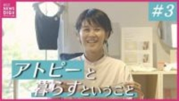 「アトピーは完治を目指さない」27年かけて辿り着いた“無理をしない日常”　 睡眠・腸活・心の持ちよう…「治そうとしない」ことで楽になれる付き合い方（全３回の３回目）