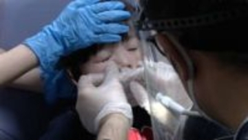 「目がかゆい」「鼻水が出る」小中学生の2人に1人が花粉症？ 発症ピークは「5歳」とも　専門医に聞く子どもの花粉症治療　体質から変える”舌下免疫療法”も