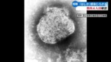高知県は11月29日、今年県内で4人目となる「はしか」の感染を確認したと発表【高知】