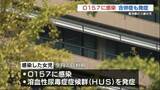 「3歳の女の子がO157に感染 合併症で急性腎不全（HUS）も　周囲でも複数人の感染者　熊本県菊池郡」の画像1