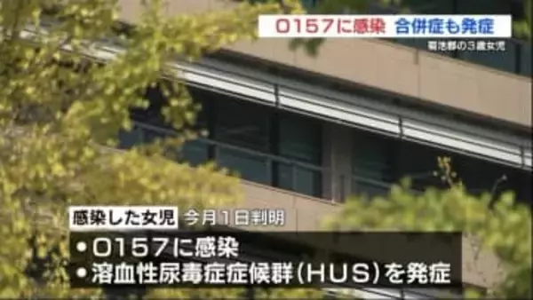 3歳の女の子がO157に感染 合併症で急性腎不全（HUS）も　周囲でも複数人の感染者　熊本県菊池郡