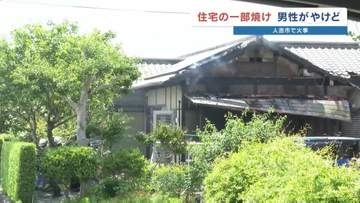 60代の男性が手と足にやけど　木造平屋の一部が焼ける