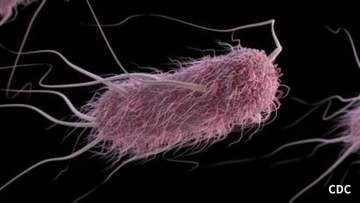 60代男性が腹痛や水様便の症状を訴える...「腸管出血性大腸菌（O157）」によるベロ毒素産生を確認...入院中も症状は軽症化【岡山】