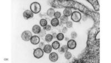 【ハンタウイルス】特性や危険度、感染力は？ 研究者が解説　過去の国内感染例は？【岡山大学】