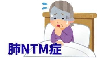 【長引く咳・痰・倦怠感・体重減少など】「肺ＮＴＭ症」の診断は？「菌がみつかった＝診断確定」ではない【徹底解説②診断】