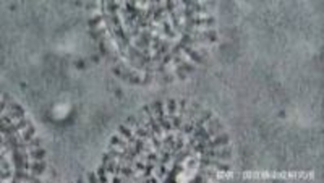 【インフルエンザ2025】今年の特徴は？いつ収束する？100以上の施設で学年・学級閉鎖【岡山・香川】