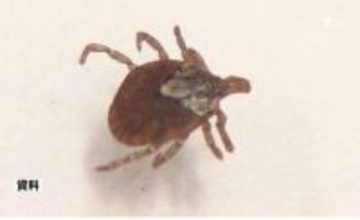 マダニ媒介の感染症「SFTS」患者 県内で2026年2人目確認 県が注意呼びかけ＝静岡県