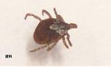 「静岡市でマダニが媒介する感染症「SFTS」患者確認 80代男性入院治療中 2021年以降市内5例目」の画像1