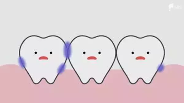 子どもの歯の「仕上げ磨き」何歳までするべき？歯科医師に聞いてみた 5歳以上の9割近くが過去に虫歯に...朝の歯磨きでタイミングよりも大切なこと