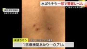 「水ぼうそう」仙南で警報レベル　１医療機関あたり４人　インフルも高水準〈宮城〉