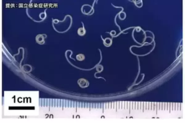 仙台市の鮮魚店でアニサキス食中毒　寿司購入の男性が腹痛　寿司のアジ・イワシ原因か