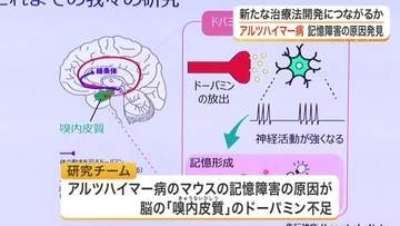 アルツハイマー病の記憶障害はドーパミン不足が原因か　東北大学などの研究チームが治療法に繋がる新発見