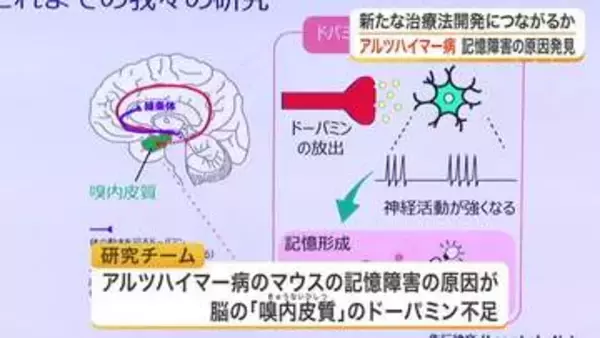 アルツハイマー病の記憶障害はドーパミン不足が原因か　東北大学などの研究チームが治療法に繋がる新発見
