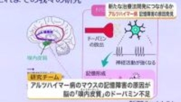 アルツハイマー病の記憶障害はドーパミン不足が原因か　東北大学などの研究チームが治療法に繋がる新発見