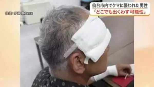 「クマだと思った瞬間、倒された」仙台市で今年初の人身被害　顔や手に傷痕残る男性が当時の恐怖を語る