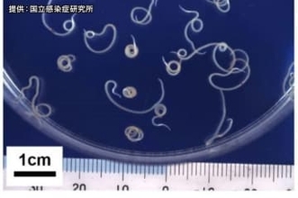 宮城県内の人気店で食中毒相次ぐ　塩釜市の寿司店でアニサキス　多賀城市では牛タンチェーンでノロウイルス