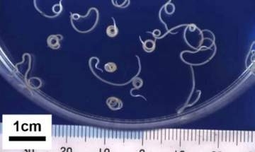 石巻市の人気寿司店でアニサキスによる食中毒　４０代男性が腹痛や嘔吐などの症状　営業一部停止に〈宮城〉