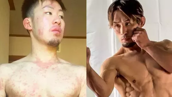 「病気が治れば幸せになれると思っていた」余命3カ月宣告から復帰した格闘家が直面した“見えない苦しみ”と社会とのズレ