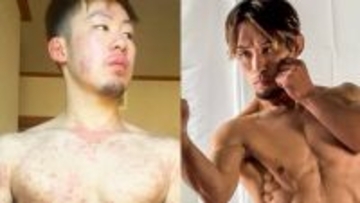 「病気が治れば幸せになれると思っていた」余命3カ月宣告から復帰した格闘家が直面した“見えない苦しみ”と社会とのズレ