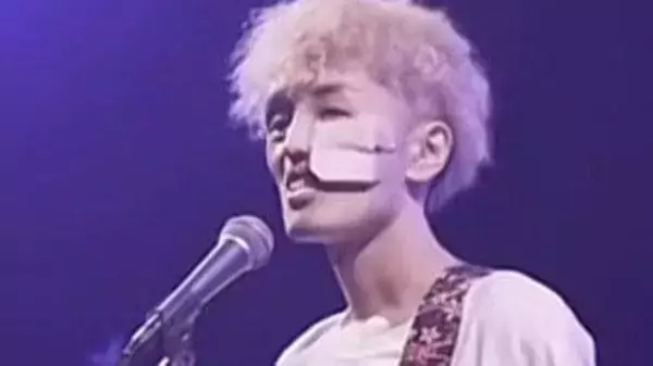 顔に穴が空く希少がん患者が死ぬ気でやったライブ、恋人のために作った曲『ナカナイカノジョ』に込めた想い