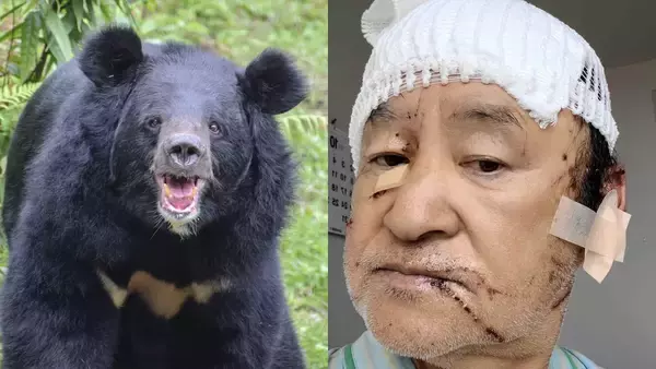 〈「クマを殺すな」の抗議殺到も…〉頭皮をはがされ頭蓋骨がむきだしになった被害者男性が独白「あの凶暴性はやられないとわからない」【2025 クマ被害記事 1位】