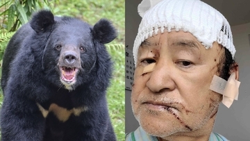 〈「クマを殺すな」の抗議殺到も…〉頭皮をはがされ頭蓋骨がむきだしになった被害者男性が独白「あの凶暴性はやられないとわからない」