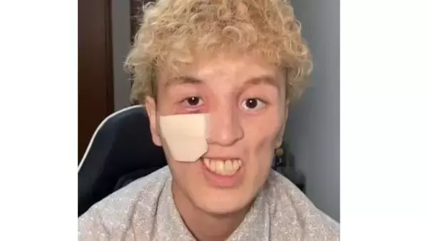 顔に穴が空き、日に日に大きく…希少がんと闘う青年の胸の内、気丈に笑う彼の人生観「僕の人生は僕だけが送っているもの」