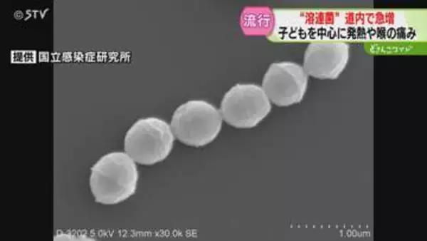 患者急増で“警報レベル”　発熱や喉の痛み「溶連菌」子ども中心に流行　春休み明け感染拡大懸念