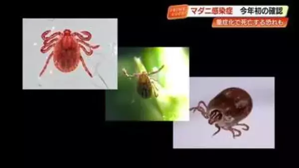 マダニ感染症「日本紅斑熱」高知で今年初確認　死亡率10%~30％「SFTS」昨年全国最多に、対策は？