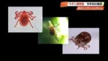 マダニ感染症「日本紅斑熱」高知で今年初確認　死亡率10%~30％「SFTS」昨年全国最多に、対策は？