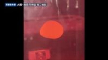 世界初 iPS細胞の再生医療が実用化へ　重症心不全とパーキンソン病が対象